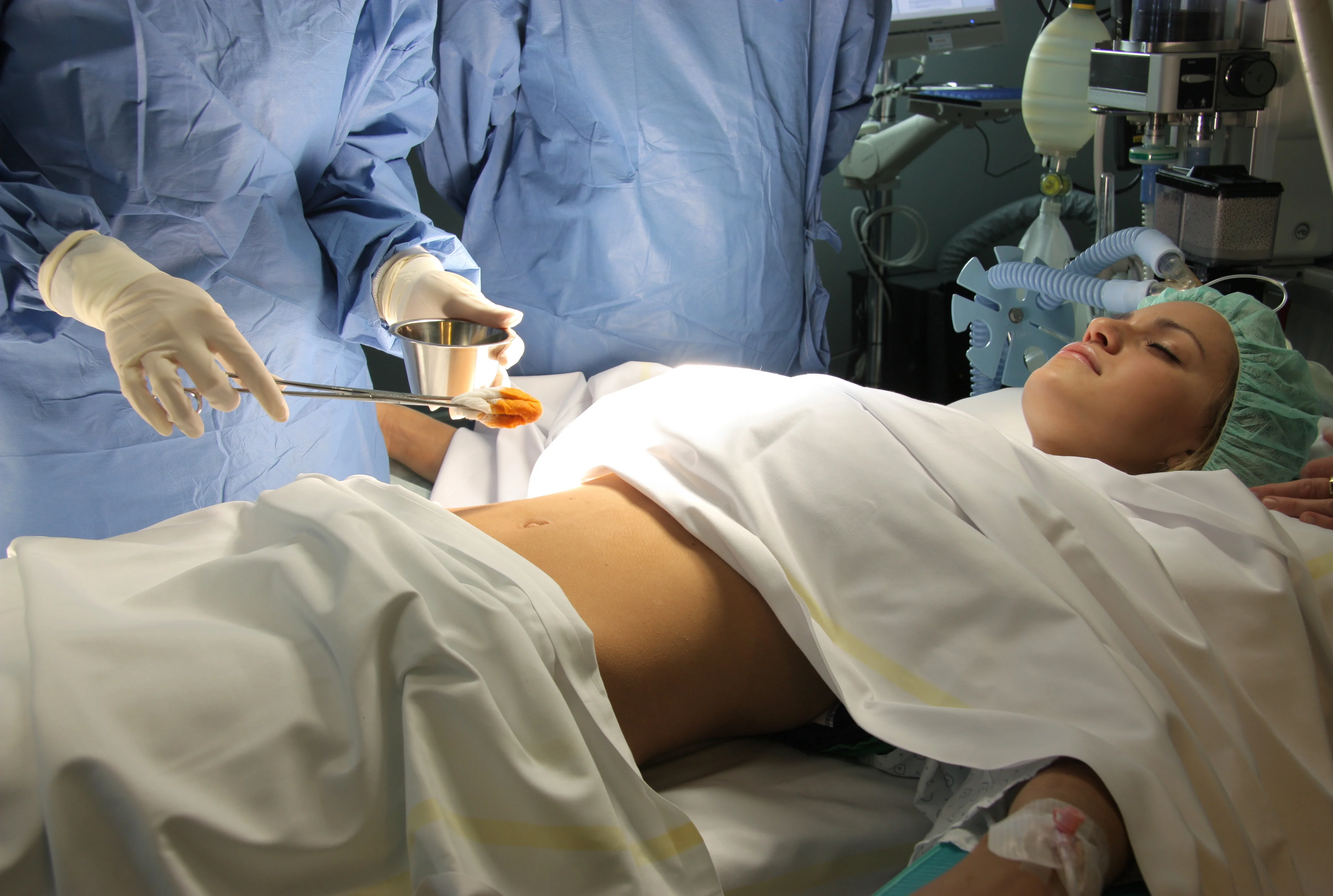 Ovarian Operations