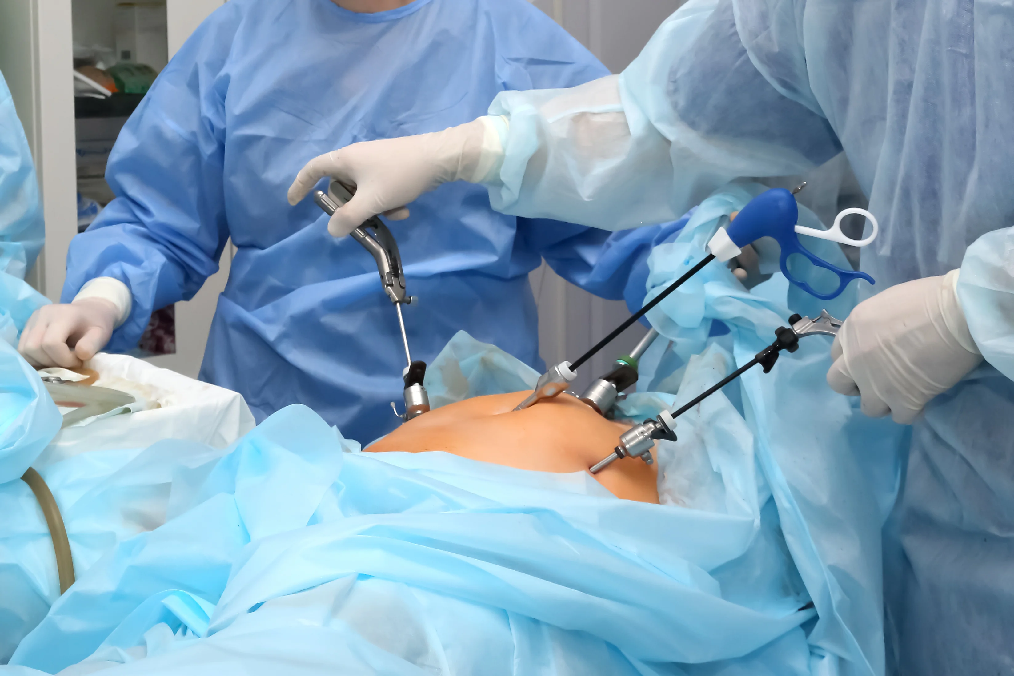 Laparoscopic