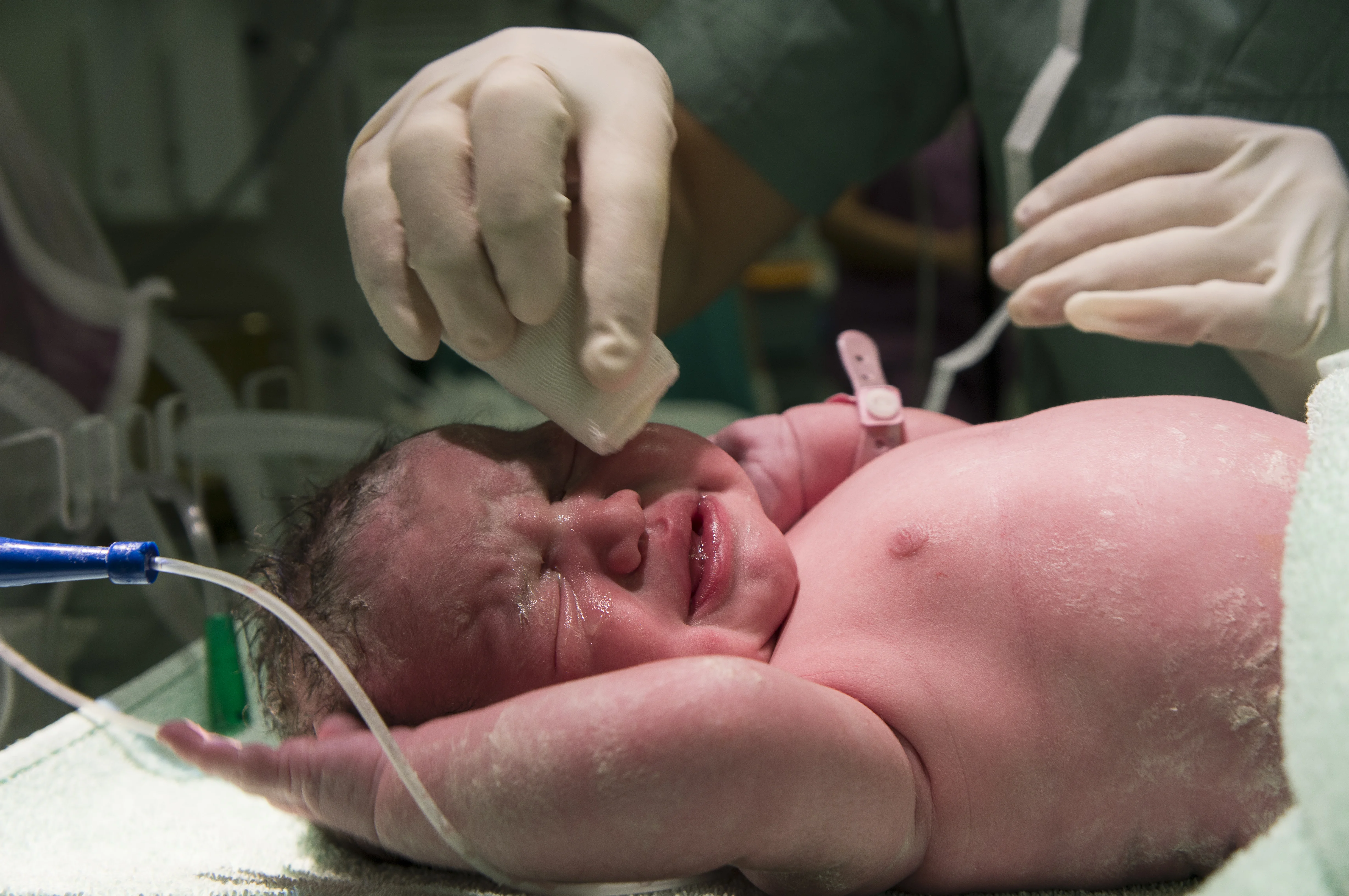 NICU tieup with Delhi New Born Centre