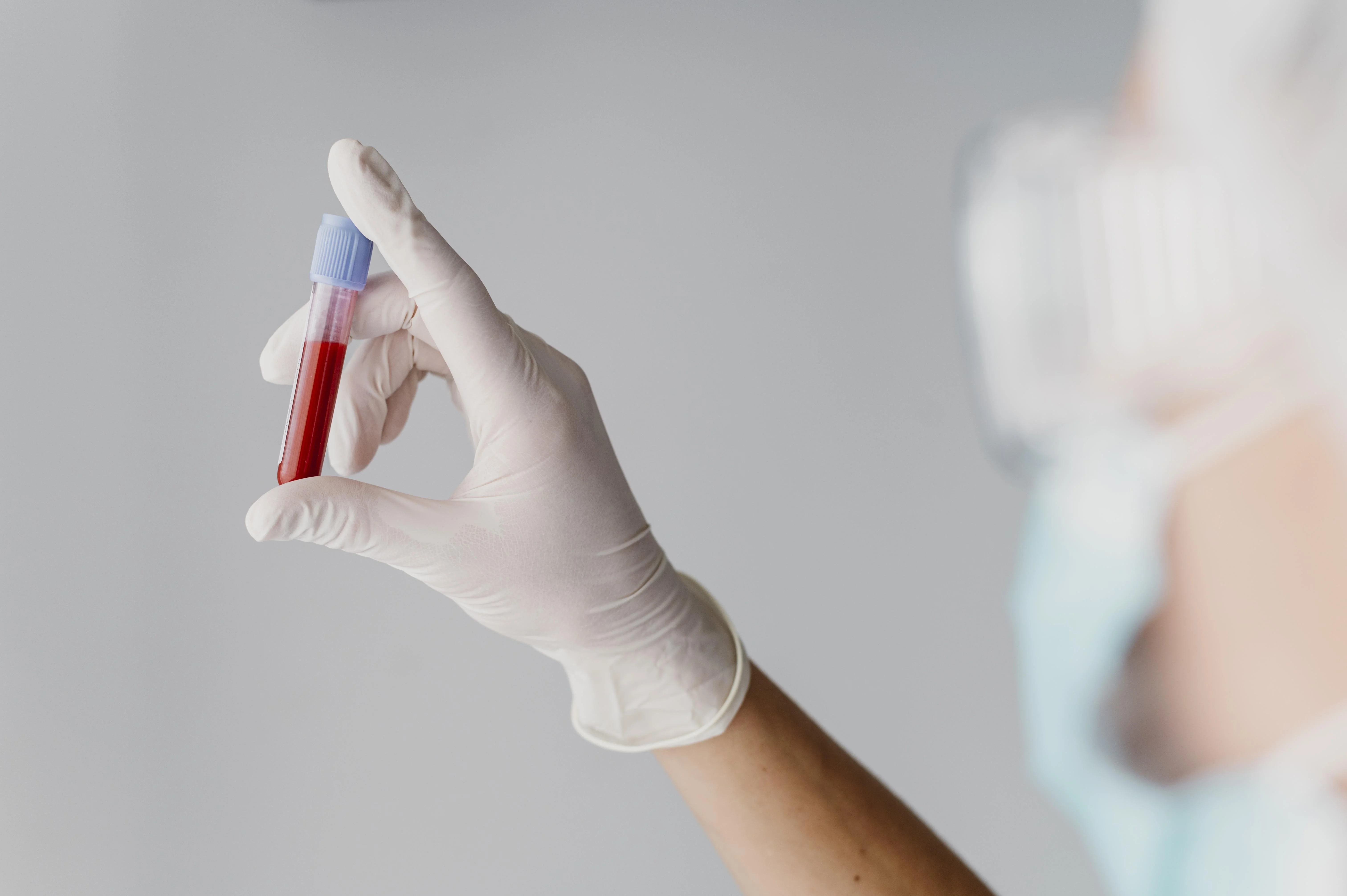 All kind of Blood Tests